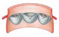 Regional anatomy Mediastinum 3 The muscular part is thick and forms the major part of the septum, whereas the membranous part is the thin, upper part of the septum.