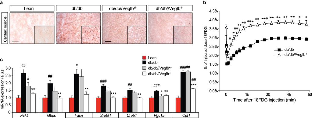 SUPPLEMENTARY INFORMATION RESEARCH Supplemental Figure S6. Genetic deletion of VEGF-B in diabetic db/db animals improves metabolic balance.
