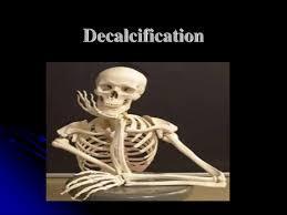 Decalcification and Clearing of Bone eg.