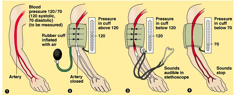 A sphygmomanometer, an inflatable cuff attached to a pressure gauge, measures blood pressure fluctuations in the brachial artery of the arm over the cardiac cycle.