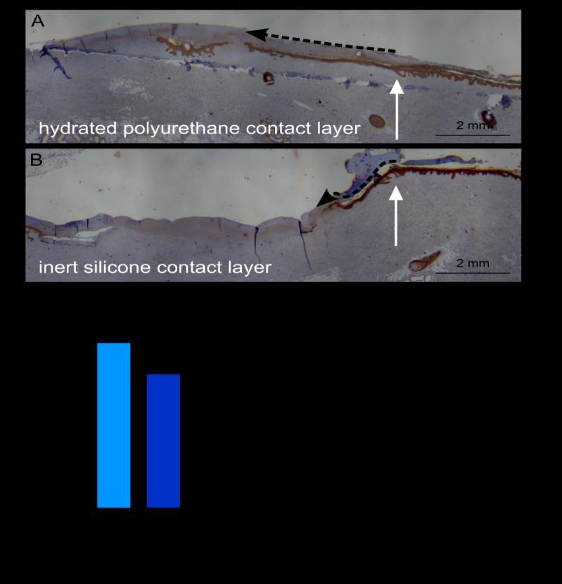 Faster epithelialization of wound when using HydroTac In Vivo Test results A B In Vivo studies