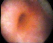 Case 1: A 23-year old male with recurrent episodes of urinary tract infection (UTI) was sent for a routine ultrasound scan after other investigations revealed bilateral vesicoureteric (VU) reflux.