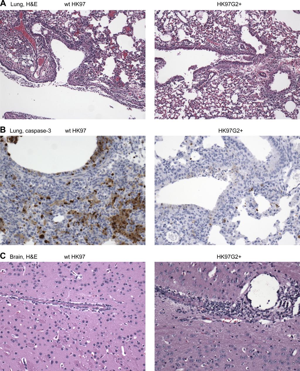 7052 SPESOCK ET AL. J. VIROL. FIG. 3. Histopathology after infection of mice with wt HK97 and HK97G2.