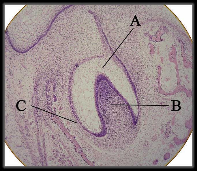 Bell stage : The cells on the periphery of the enamel organ separate into three important layers: Cuboidal cells on the periphery of the dental organ form the outer enamel epithelium.