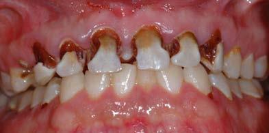 CAVITIES: Unevenly Distributed Low