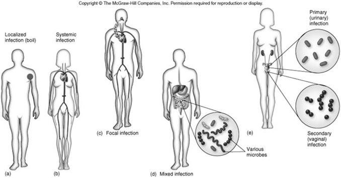 Relative Virulence 23 Establishment of infections vary