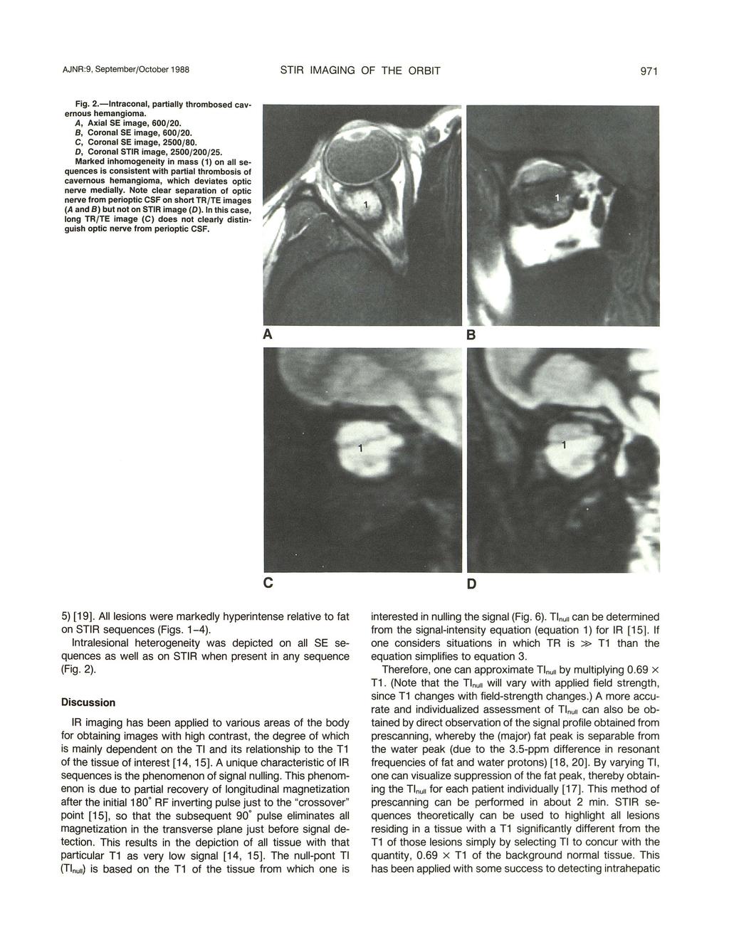 JNR:9, September/Otober 1988 STIR IMGING OF THE ORIT 971 Fig. 2.-lntraonal, partially thrombosed avernous hemangioma., xial SE image, 600/20., Coronal SE image, 600/20. C, Coronal SE image, 2500/80.