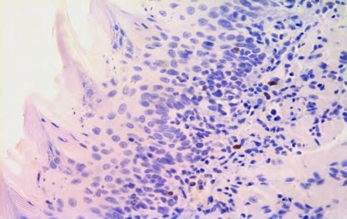 data are pooled from two independent experiments () Histological immunostaining showing expressing cells (arrows) in the tongue in Treg recipients on day 7 after infection (4X