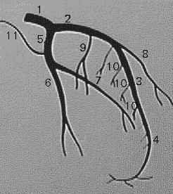 Branches of the Left Coronary 1. Main left coronary artery 2. Proximal LAD 3. Mid LAD 4. Distal LAD 5. Circumflex 6.