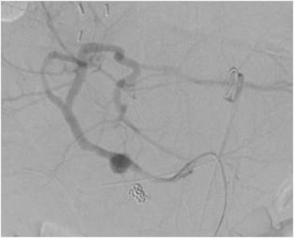 Fig. 26: Angiography