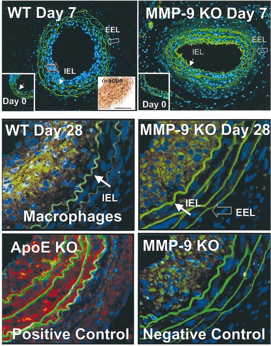 Galis et al MMP-9 Deficiency and Arterial Remodeling 5 Figure 3. MMP-9 deficiency reduces the extent of intimal hyperplasia (fluorescence microscopy).
