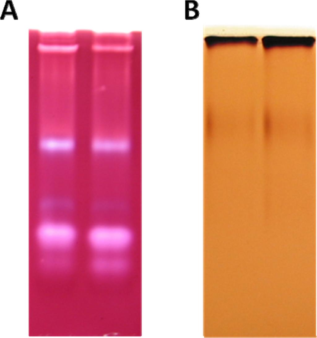 Fig. S2. Detection of starch metabolism enzymes by zymograms.