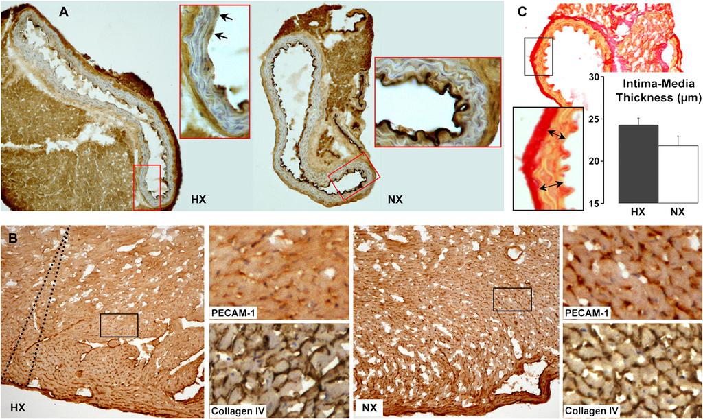 Dematteis, Julien, Guillermet, et al.: Hypoxia and Cardiovascular Changes 233 Figure 7. Histologic cardiovascular alterations induced by 14 days of intermittent hypoxia.