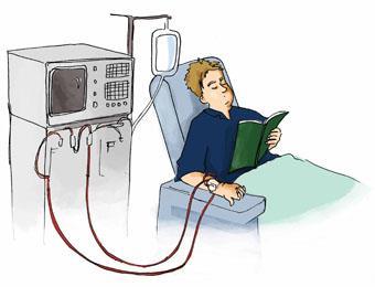 Hemodialysis Dialysis: