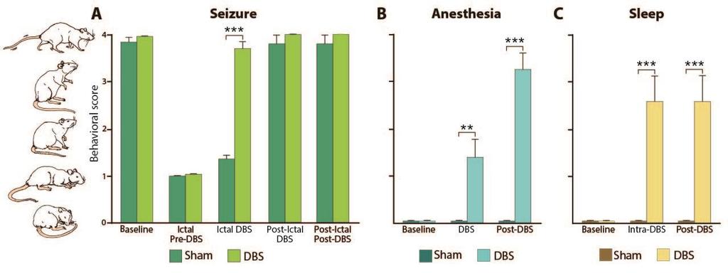 Kundishora 45 Figure 7. Behavioral arousal with dual-site CL+ PnO DBS during focal limbic seizures, anesthesia-induced sleep, and natural sleep.