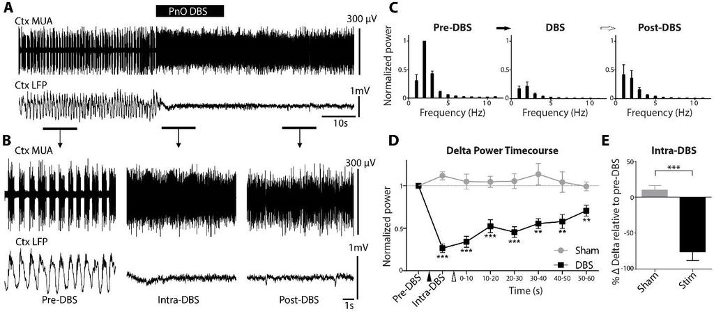 Kundishora 48 Supplementary Figure 2. Example of stimulation and group data for PnO stimulation in animals under deep anesthesia. (A) PnO DBS under deep anesthesia eliminates cortical slowing.