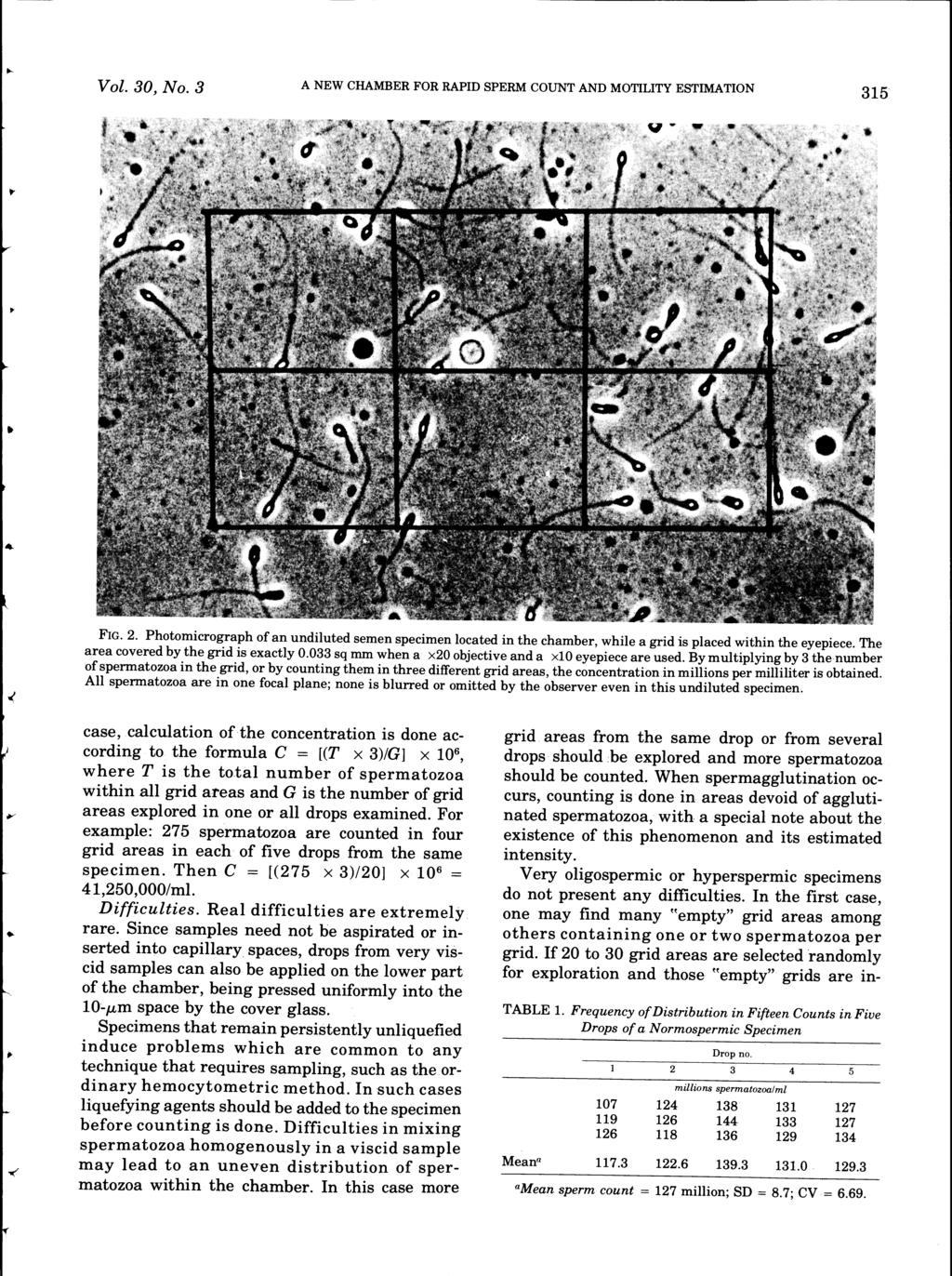 Vol. 30, No.3 A NEW CHAMBER FOR RAPID SPERM COUNT AND MOTILITY ESTIMATION 315 FIG. 2. Photomicrograph of an undiluted semen specimen located in the chamber, while a grid is placed within the eyepiece.