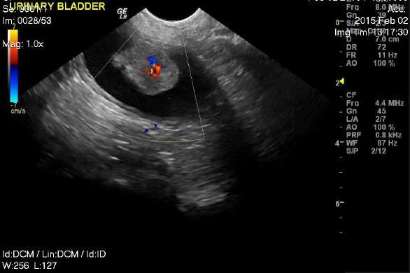 Differential Diagnosis Serosanguinous Vulvar Discharge Urinary