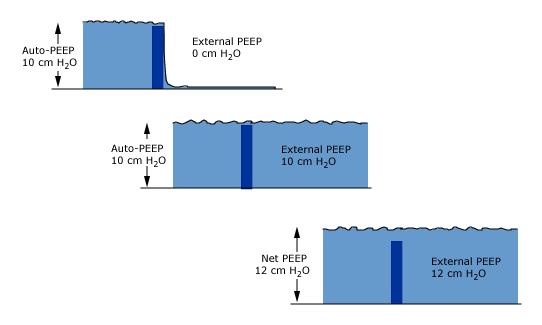 The use of external PEEP in the setting of auto-peep may be conceptualized by the "waterfall over a dam" analogy.
