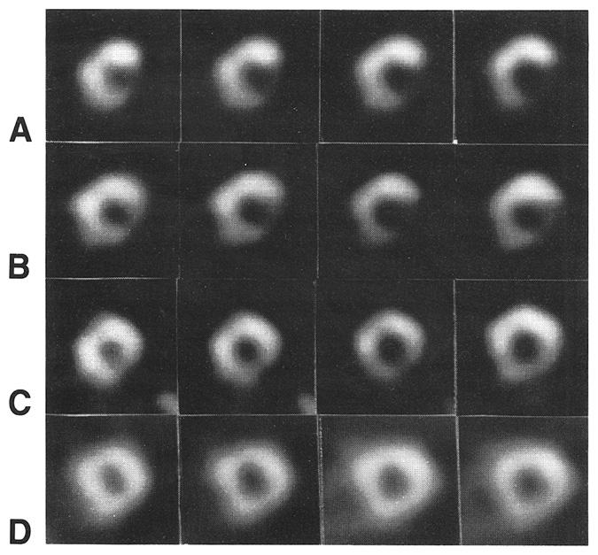 reversible at 4 h Late Imaging Group (n = 118) 8.9 ± 3.6 20.9 ± 9.5 6.5 ± 3.6 16.7 ± 9.1 26 *Mean number of segments ± SD; tmean ± SD. 4 h Imaging Group (n = 98) 8.1 ± 4.0 18.8 ± 10.5 5.3 ± 3.3 14.