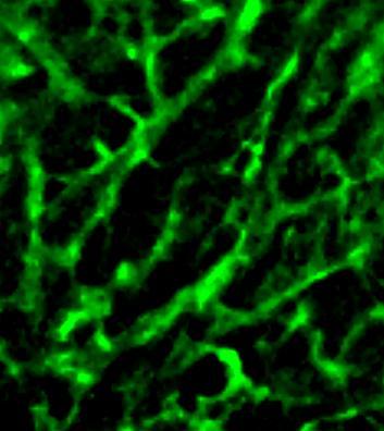 () Fluorescence intensity of fibronectin along the white line shown in.