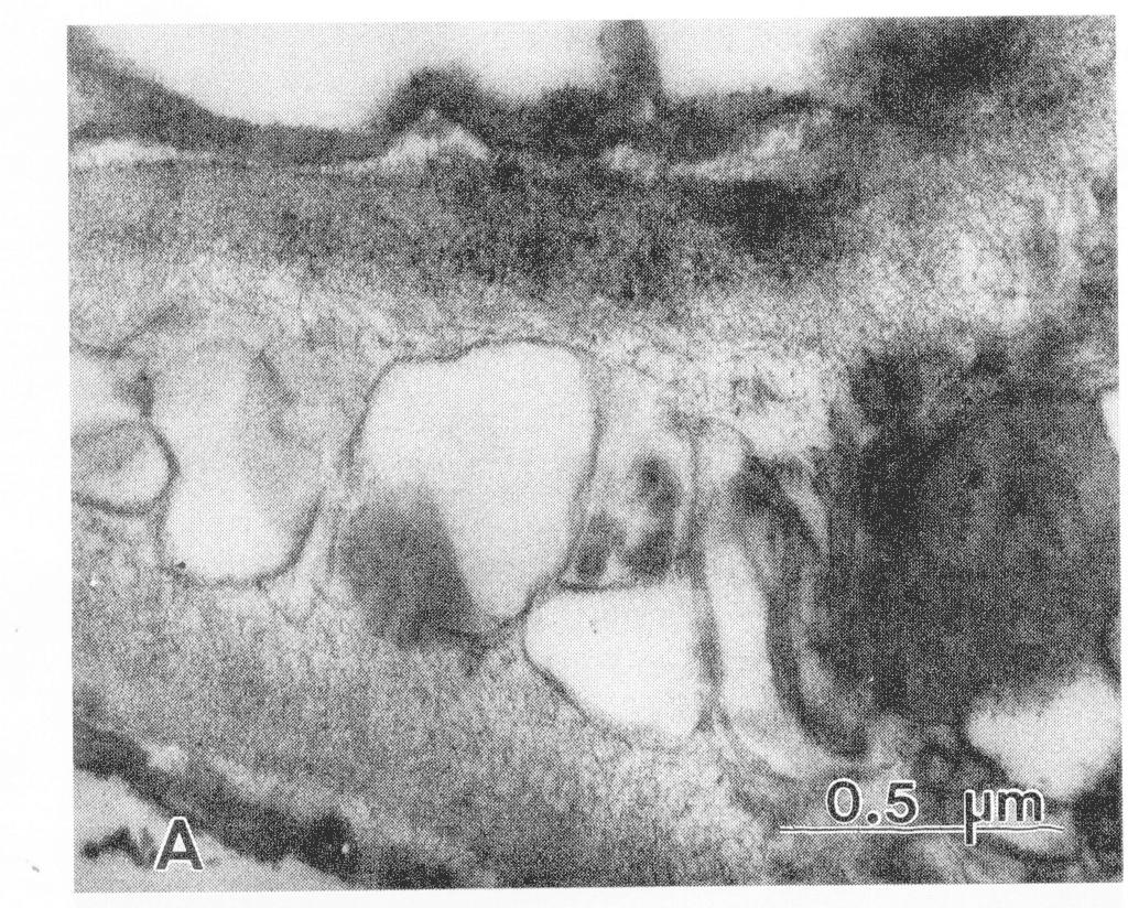 Fig. 7. Scanning electron micrograph of frozen-hydrated cortical apple cells from fruit after 6 months of storage. Extracellular material associated with the middle lamella is visible.