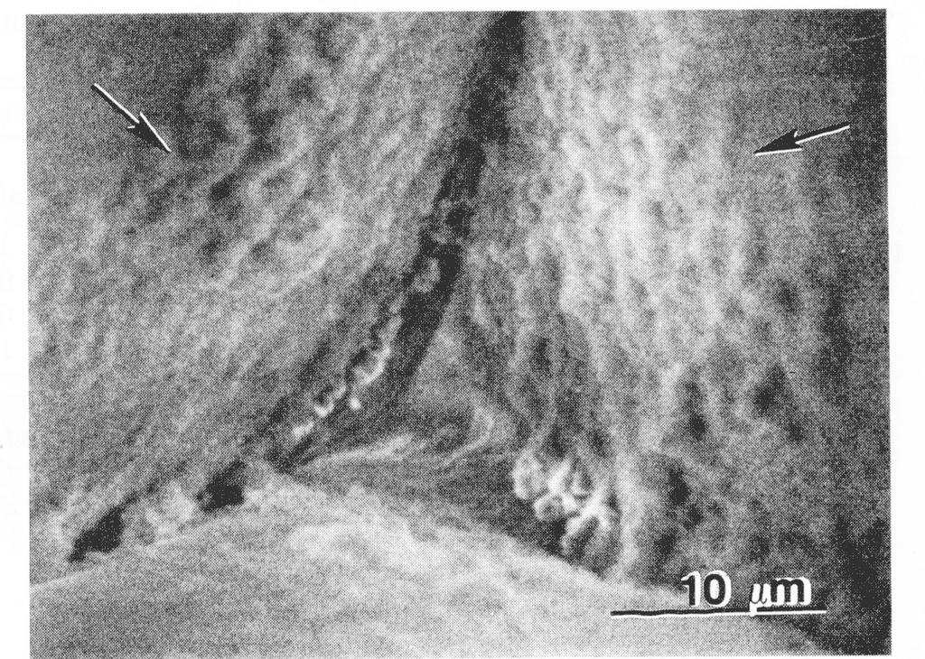 Transmission electron micrographs of ultrathin sections prepared from untreated (A) and Ca-treated (B) apples that had been cold-stored (4C) for 6 months.
