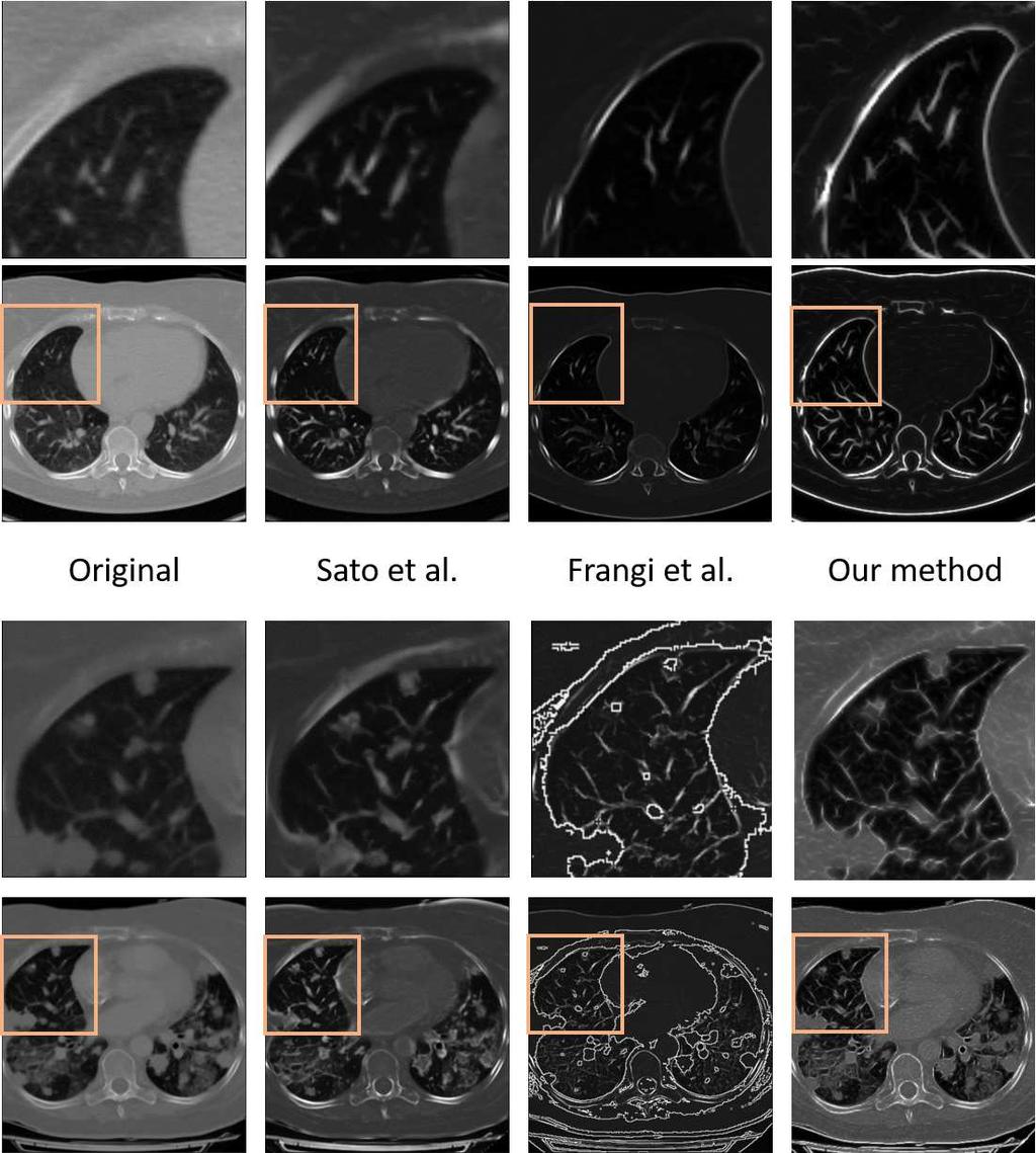 Figure 2: These series show the original images and the results of the aforementioned methods.