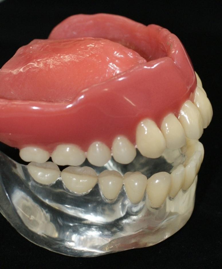 Dentures : Removable for