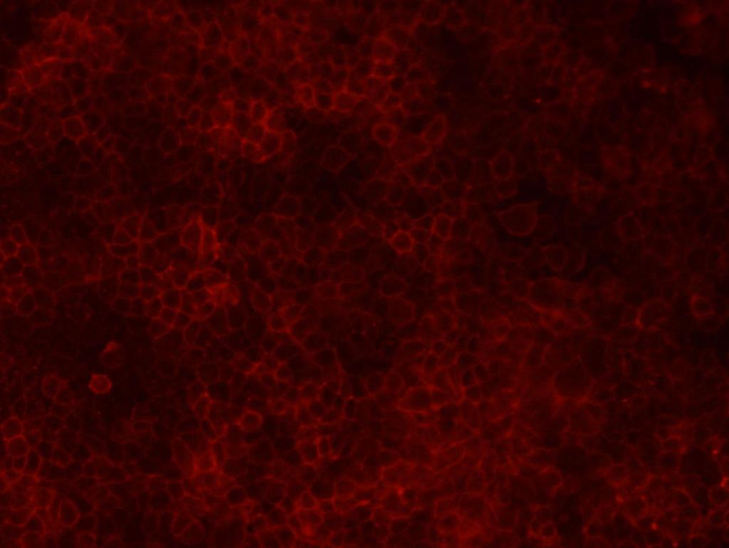 a moment. Observation under fluorescence microscope. The red fluorescence on the cells membrane is internalized into the cells. Photo recorded. 3. Results 3.1.