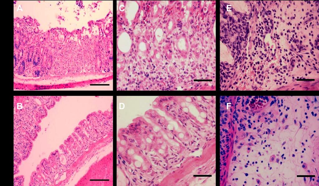 Supplementary Figure 8: DSS-induced acute colon inflammation. Ascending colon from WT and mfpr2 -/- littermates treated with 5% DSS for 4 days was sectioned (5 μm) and stained with H&E. A-B.
