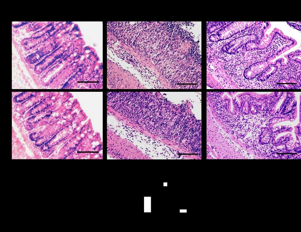 Supplementary Figure 11: Histological changes in DSS-induced acute colitis in mice with myeloid cell specific deletion of mfpr2. A.