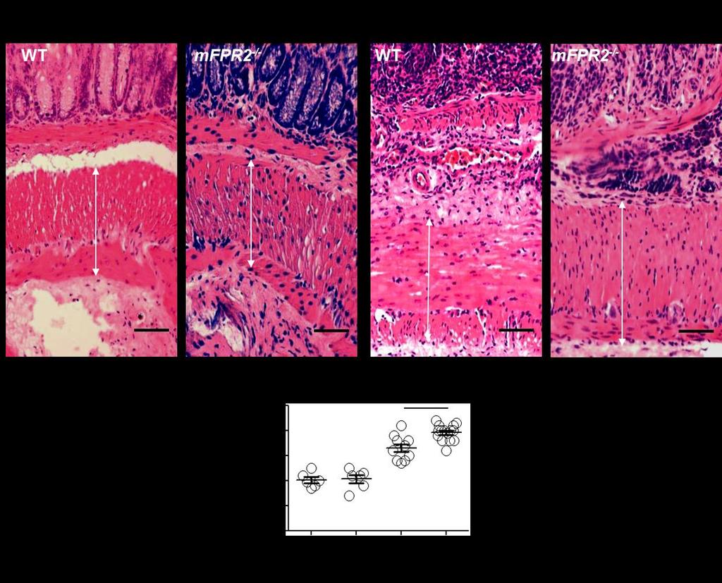 Supplementary Figure 14: DSS-induced chronic colon inflammation in WT and mfpr2 -/- mice. A.