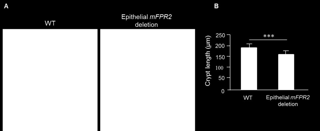 H&E sections of colons from WT mice (Vallin-Cre (-) mfpr2 flox/flox ) or mice with epithelial cell specific deletion of