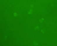 cells in HEMA-coated plate for 12 hr and cell