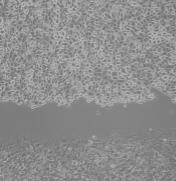 One set of BRAFV6E/ was treated with 1µM
