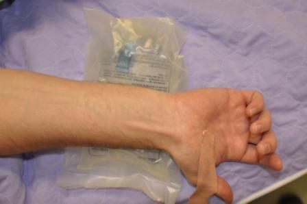 Positioning Kylie absorbent mat under arm Dorsiflexed, supinated wrist on flat surface over