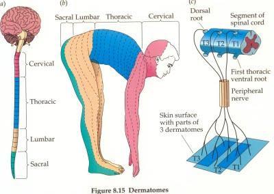 Pain from Disc Pathology and Dermatomal Distribution Pain can be discogenic, radicular or both.
