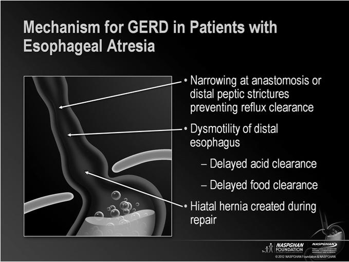 Questions: Management and Surveillance of GERD in EA/TEF? When to initiate and how long to continue acid suppression? When to consider anti-reflux surgery, and how best to perform this?