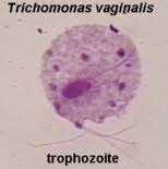 Other common STDs (non bacterial or viral): STD caused by protozoan: Trichomoniasis (Trichomonas vaginalis) 70%
