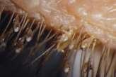 lice is a parasitic insect that feeds exclusively on blood.