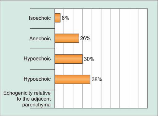 anechoic, and 3 (6%) were isoechoic as compared with normal thyroid parenchyma (Figs 9 to 12)