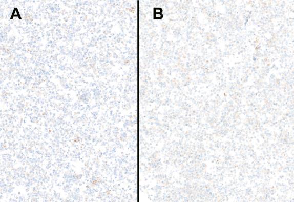 Image 2: Optimal staining of the NEQAS moderately positive cell line (Core B).