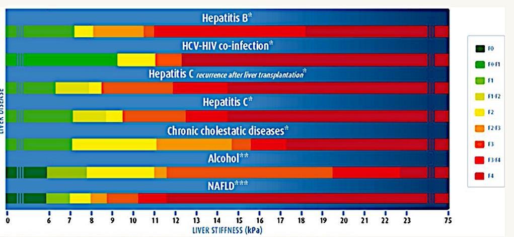 Correlation Between Liver Stiffness (kpa) & Fibrosis Stage *Gastroentérol Clin Biol. 28;32,58-67; **J Hepatol.