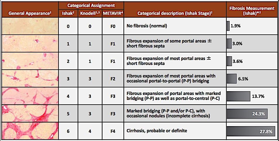 Liver Biopsy Appearance and Categories of Fibrosis 1. Brunt EM. Hepatology. 2;31:241-246; 2.Standish R, et al. Gut.