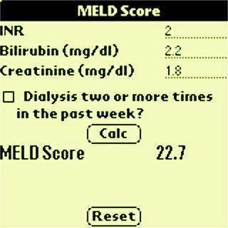 MELD=Model for End Stage Liver Disease MELD and MELD Sodium are useful to predict survival in patients