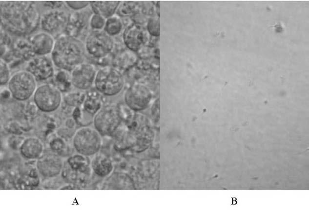 Figure 4. Mean initial and overnight sperm motility with and without exposure to polydimethylsiloxane (PDMS) and latex (n = 5). Columns with different case letters are significantly different (P < 0.