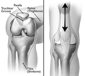 (Left) The patella normally rests in a small groove at the end of the femur called the trochlear groove. (Right) As you bend and straighten your knee, the patella slides up and down within the groove.