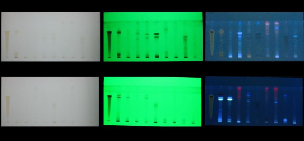 Figure 3.3.5(B-1): TLC chromatogram for Methanol extracts before derivatization visualized in various lights representing separated compounds Figure 3.3.5(B-2): TLC chromatogram for Methanol extracts after derivatization visualized in various lights representing separated compounds Figure 3.