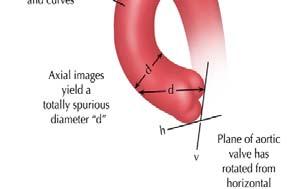 of aorta Need multiple modalities Compare images versus